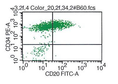 CD34 vs CD20
